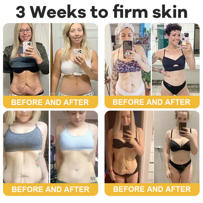 💐Hiskin® Botox Silk Body Oil Rediscover confidence with firmer, smoother, radiant skin