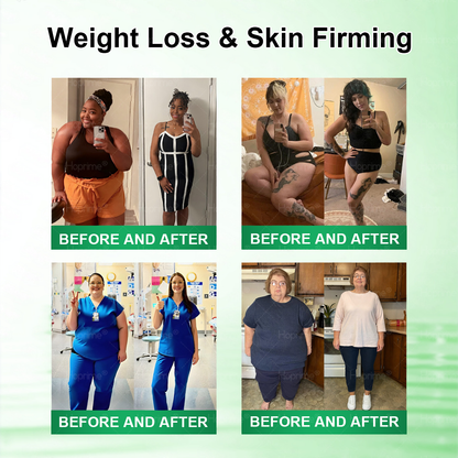 🇺🇸𝑯𝒐𝒑𝒓𝒊𝒎𝒆®🎁 Only 5 boxes left! We are offering you an additional 30% discount! Make your body healthier. If you miss it now, you won't get it until next year.