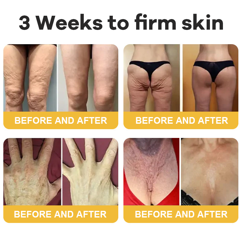 💐Hiskin® Botox Silk Body Oil Rediscover confidence with firmer, smoother, radiant skin