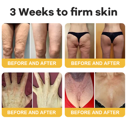 💐Hiskin® Botox Silk Body Oil Rediscover confidence with firmer, smoother, radiant skin