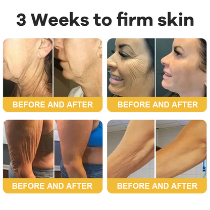 💐Hiskin® Botox Silk Body Oil Rediscover confidence with firmer, smoother, radiant skin