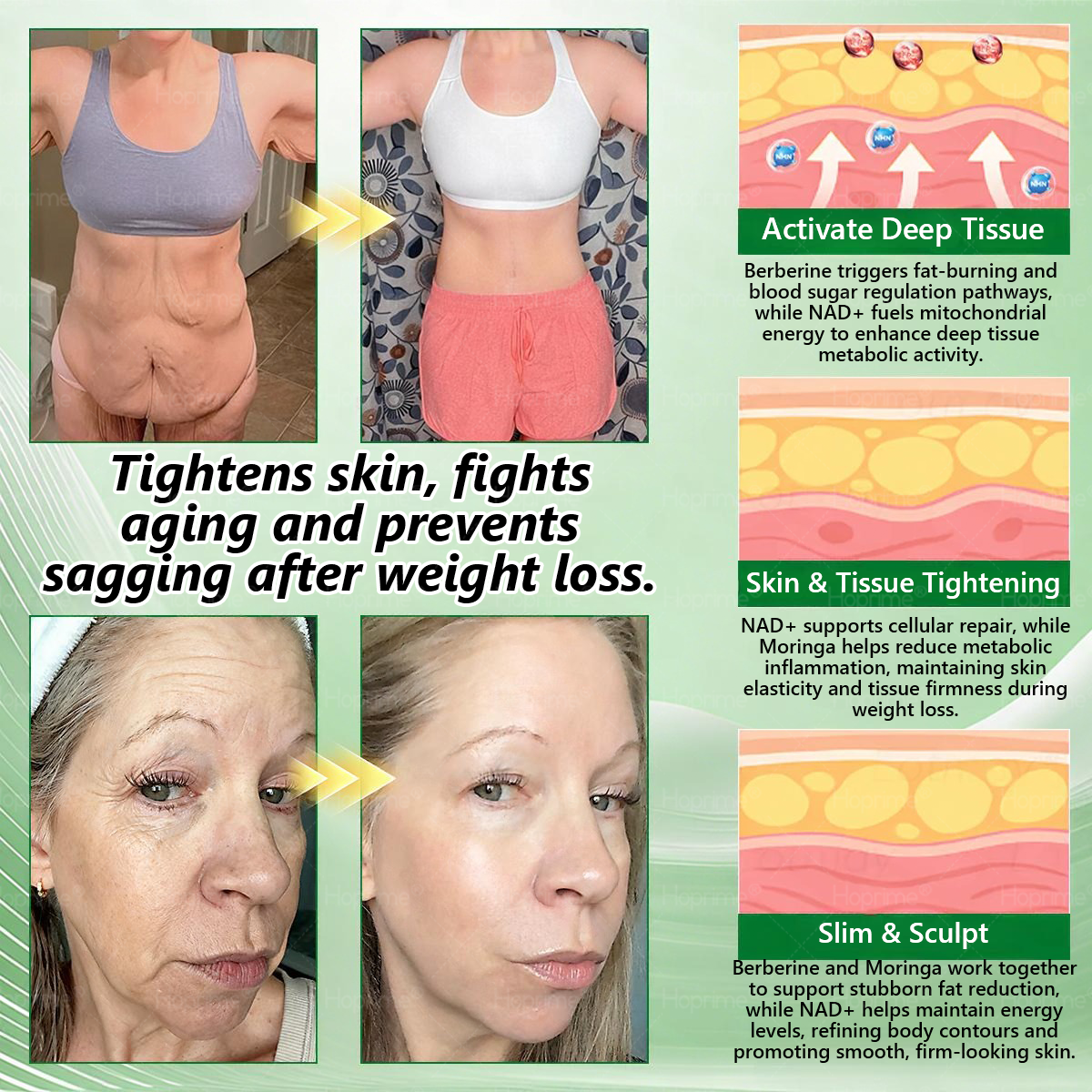 🇺🇸𝑯𝒐𝒑𝒓𝒊𝒎𝒆®🎁 Only 5 boxes left! We are offering you an additional 30% discount! Make your body healthier. If you miss it now, you won't get it until next year.