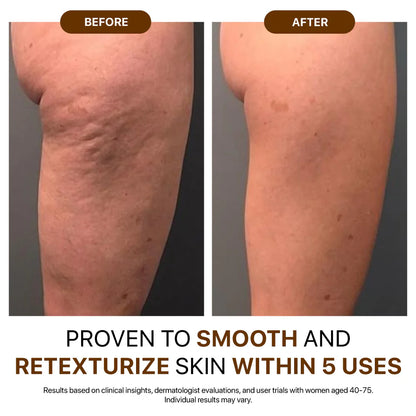 💐Hiskin® Botox Silk Body Oil Rediscover confidence with firmer, smoother, radiant skin