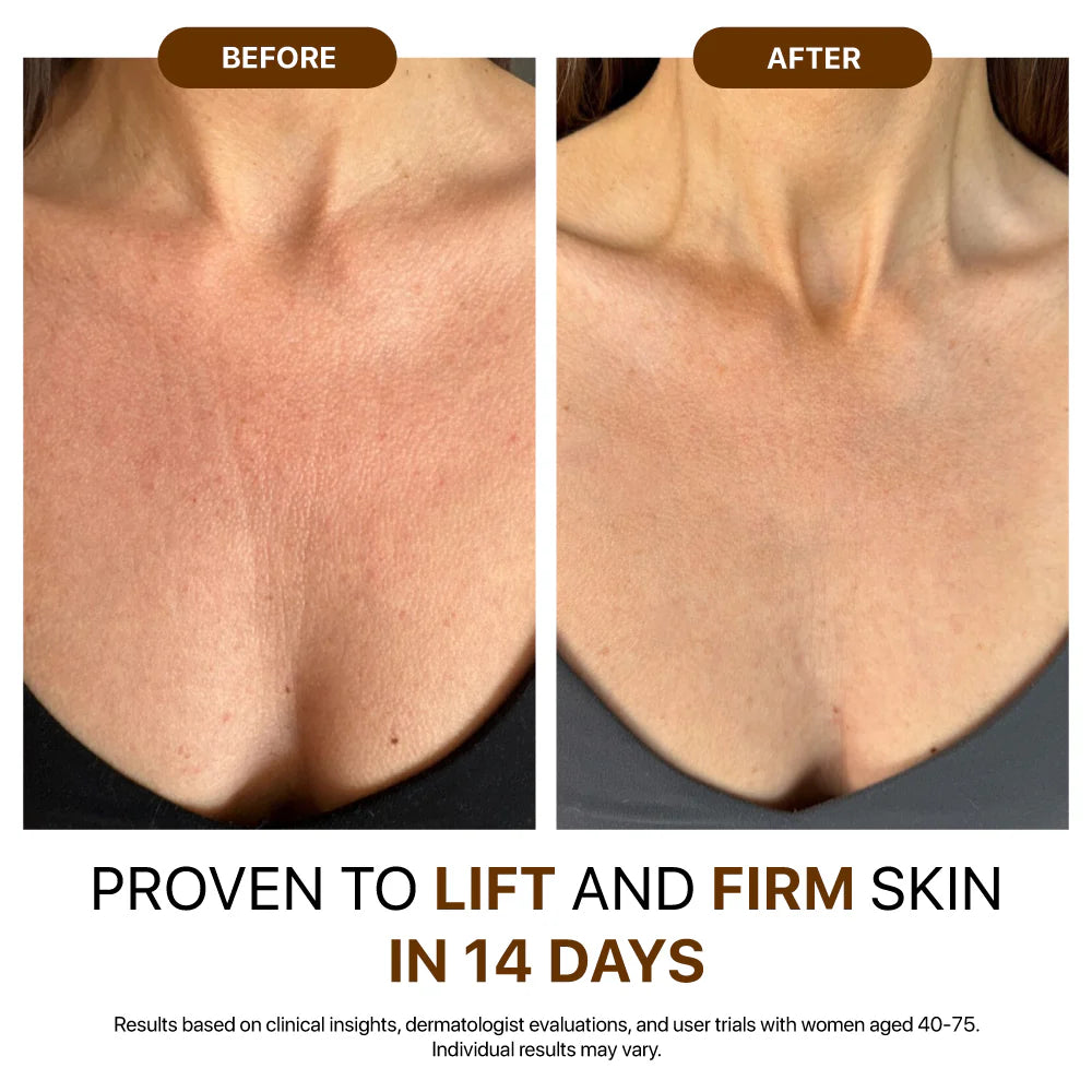 💐Hiskin® Botox Silk Body Oil Rediscover confidence with firmer, smoother, radiant skin