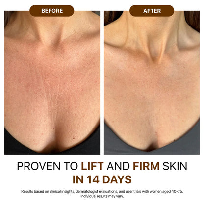 💐Hiskin® Botox Silk Body Oil Rediscover confidence with firmer, smoother, radiant skin