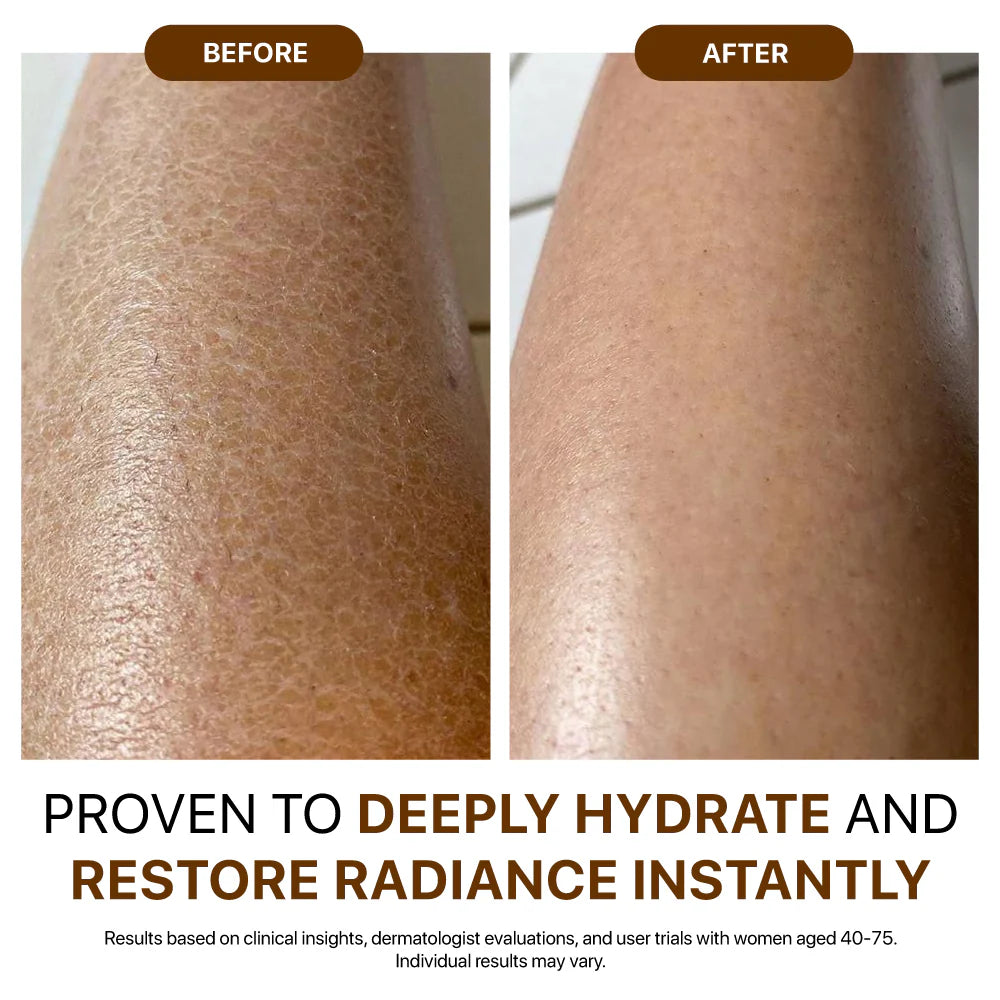 💐Hiskin® Botox Silk Body Oil Rediscover confidence with firmer, smoother, radiant skin