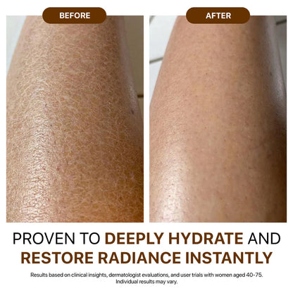 💐Hiskin® Botox Silk Body Oil Rediscover confidence with firmer, smoother, radiant skin